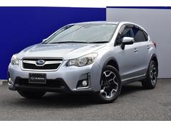 XV