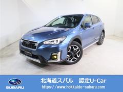 XV