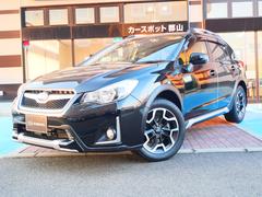 XV