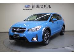 XV