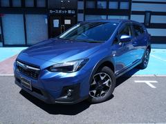 XV