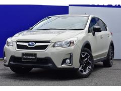 XV