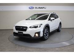XV