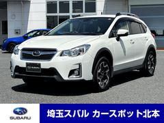 XV