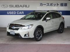XV