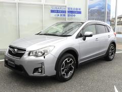 XV